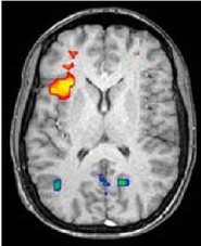 brain imaging